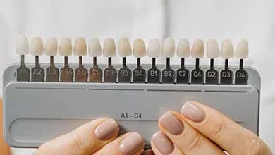 Hands hold a dental shade guide displaying artificial teeth in various white and yellow shades, each coded.